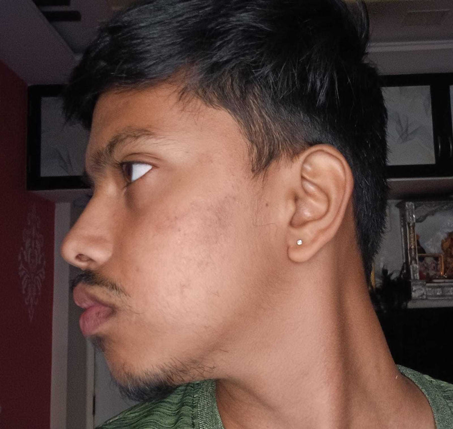 Avaneesh before