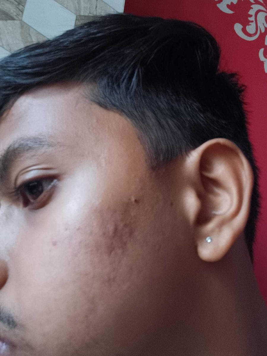 Avaneesh after
