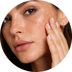 Acne Reduction In 4 Weeks*