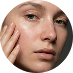 Fewer Inflamed Acne*