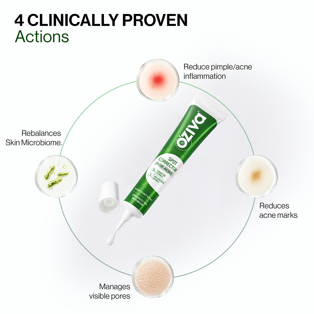 Spot Corrector for Acne | Starts acting in 24 hours